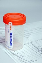 Clinical semen specimen bottle for fertility testing